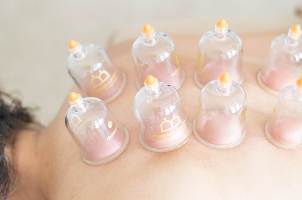 Hijama voor mannen voor gezondheid - Hijama praktijken in Nederland | Hijama Clinic Sunnah - Hijama praktijken in Nederland | Hijama Clinic Sunnah